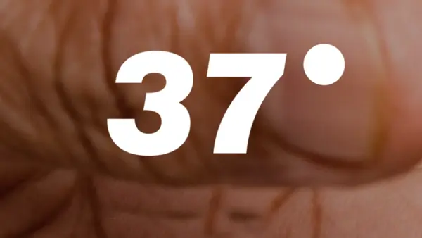 37 Grad